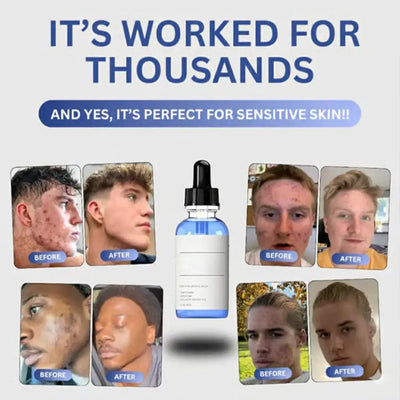 Copper Peptides Repair Serum w/ Hyaluronic Acid