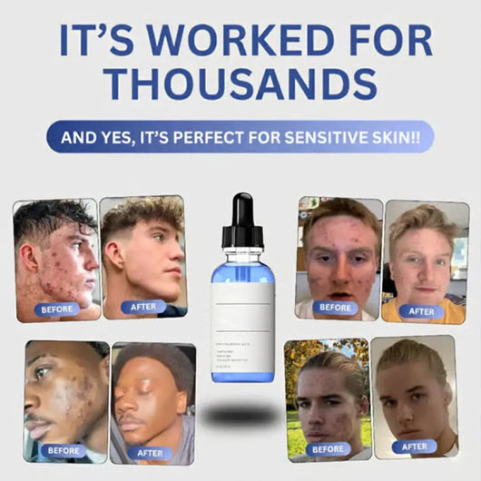 Copper Peptides Repair Serum w/ Hyaluronic Acid